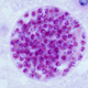 T. gondii cyst in a mouse brain. (Image: Wikimedia Commons)